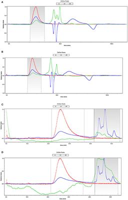 The Inhibitory Effects of Hericium erinaceus β-glucan on in vitro Starch Digestion